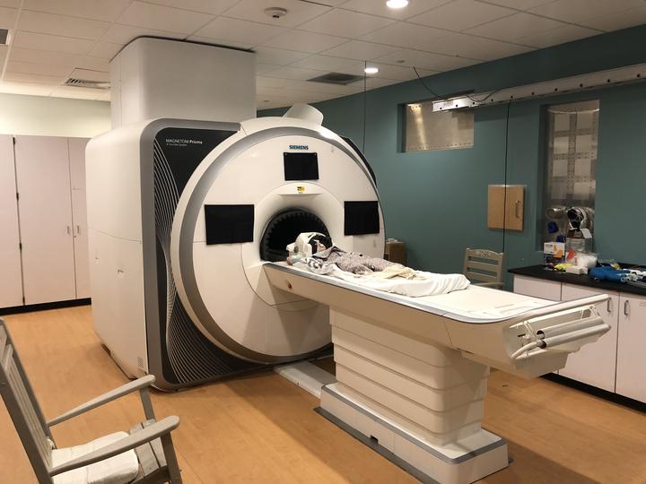 CMV Infant MRI Scan